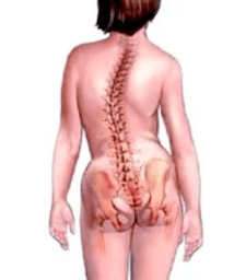 Pathologie du système musculo-squelettique