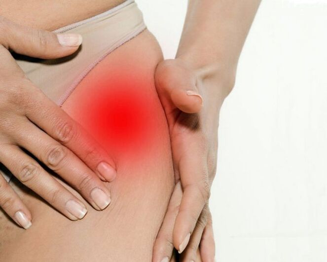 Ingue et douleurs de cuisse avec l'arthrose de l'articulation de la hanche